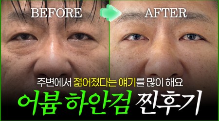 한 달 만에 티 안나게 젊어지는 비결…